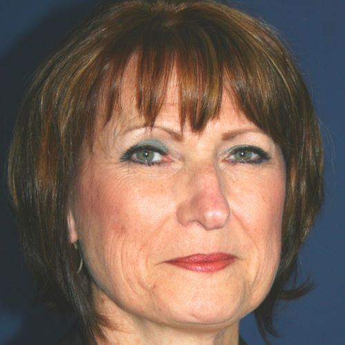 SUBJECT MATTER EXPERT