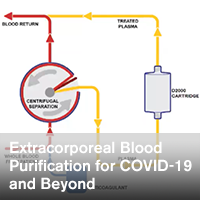Extracorporeal Blood Purification for COVID-19 and Beyond - ~/sccm/media/covid19rl/COVID-19-Extracorporeal-Blood-Purification-for-COVID-19.png?ext=.png